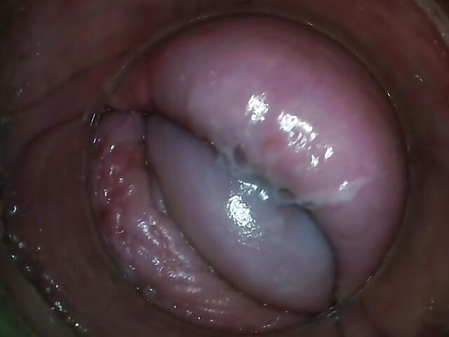 Tiny Tina - Camera inside pussy in the car