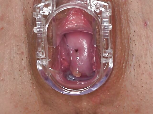 Lara Fox's pussy gape solo with a speculum