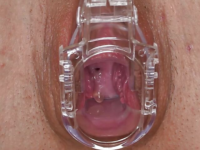 Lara Fox's pussy gape solo with a speculum