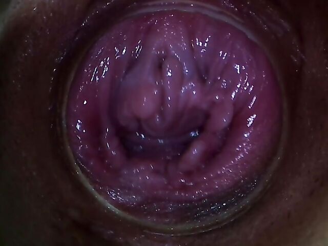 Endo camera inside pussy to explore Paula Shy's vagina