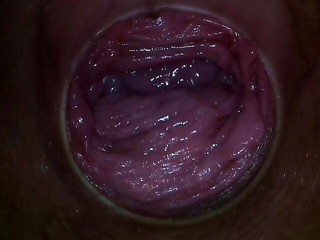 Endo camera inside pussy to explore Paula Shy's vagina