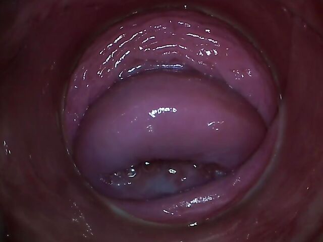 Endo camera inside pussy to explore Paula Shy's vagina