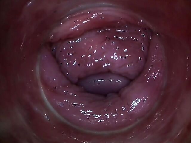 Endo camera inside pussy to explore Paula Shy's vagina