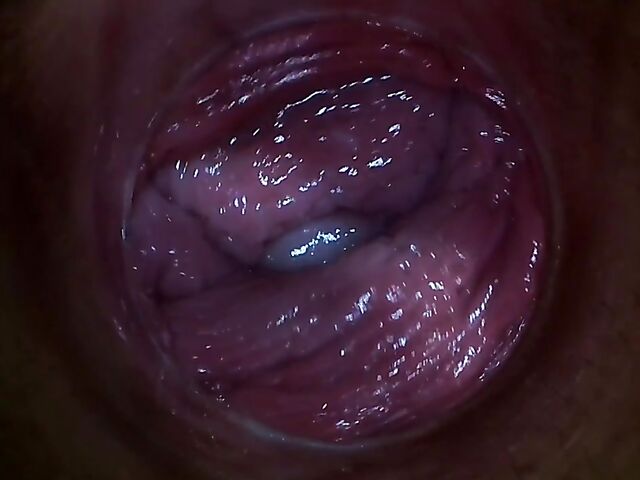 Endo camera inside pussy to explore Paula Shy's vagina