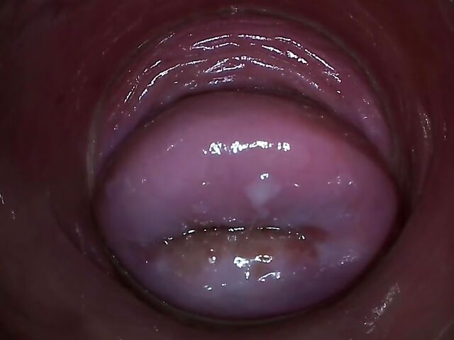 Endo camera inside pussy to explore Paula Shy's vagina