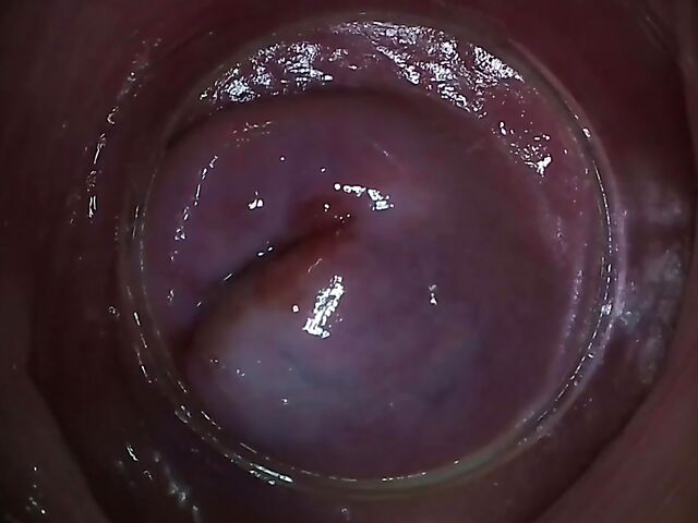 Endo camera inside pussy to explore Paula Shy's vagina