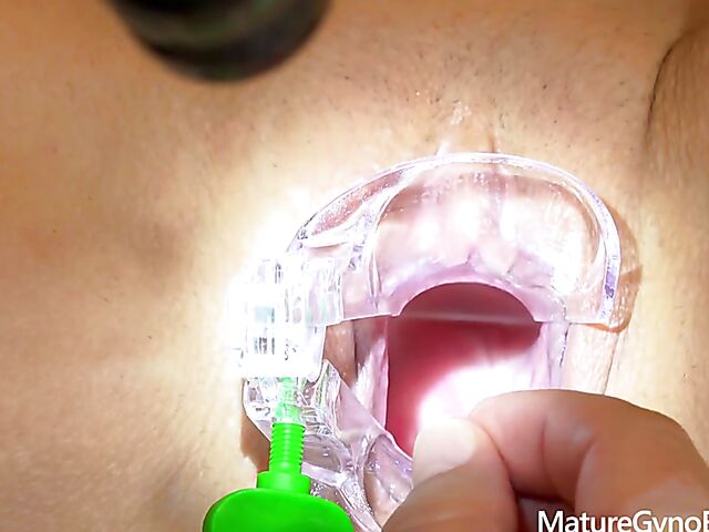 Gyno exam with shaved mature lady Emily Devine