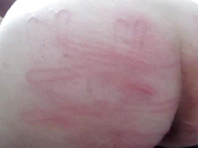 Fat ass woman electro shocked